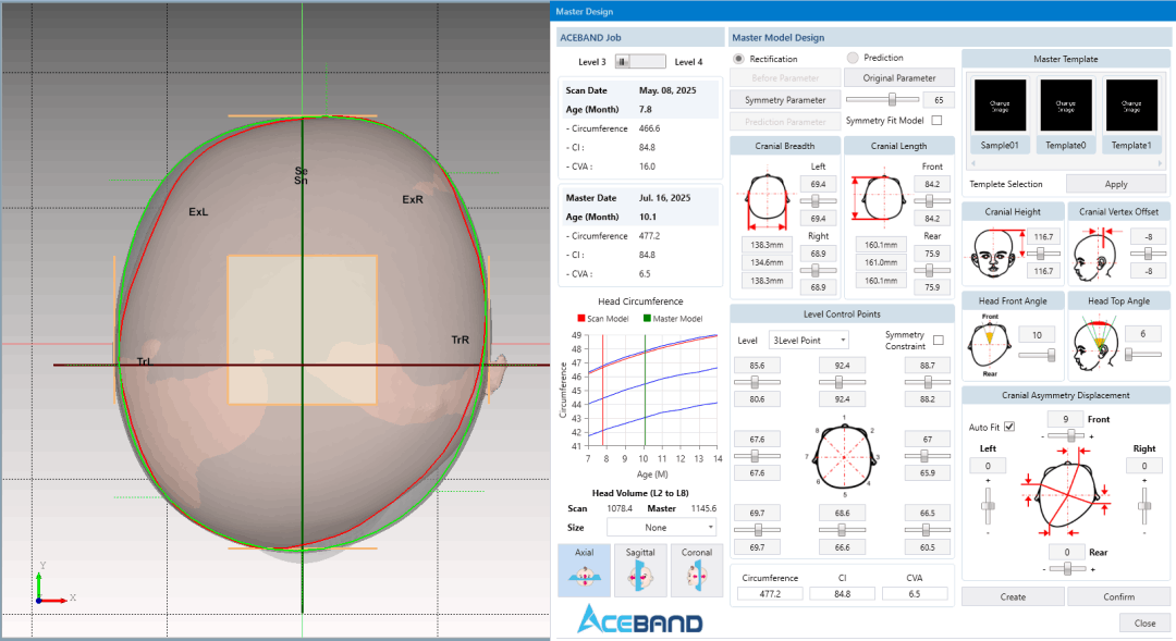 ACEBAND Design